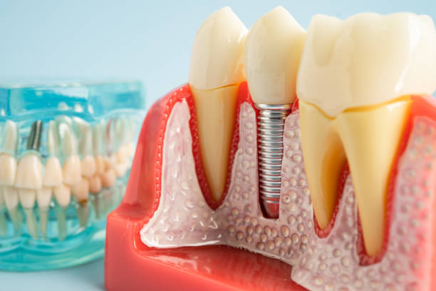 Professional Dental Services in Reserve, LA